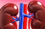 مهمترین علت ابتلا به سنگ کلیه